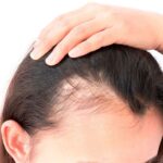 Vitaminas para el cabello