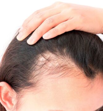 Vitaminas para el cabello